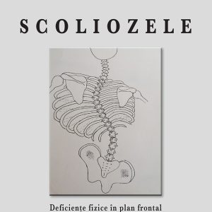 Scoliozele
